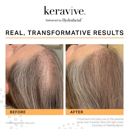 Keravive_Scalp_Therapy_Headspa_Riverton