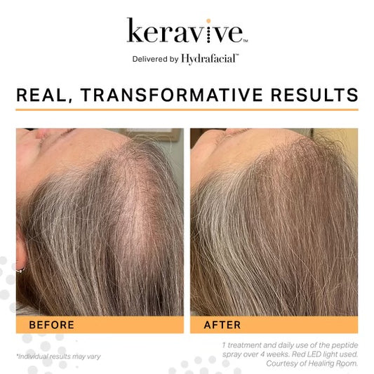 Keravive_Scalp_Therapy_Headspa_Riverton